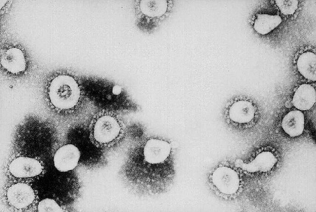 Nhật Bản đã phân lập thành công Coronavirus mới