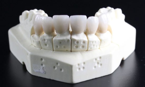 Y học cổ truyền Trung Hoa đã có câu trả lời cho bệnh đau răng