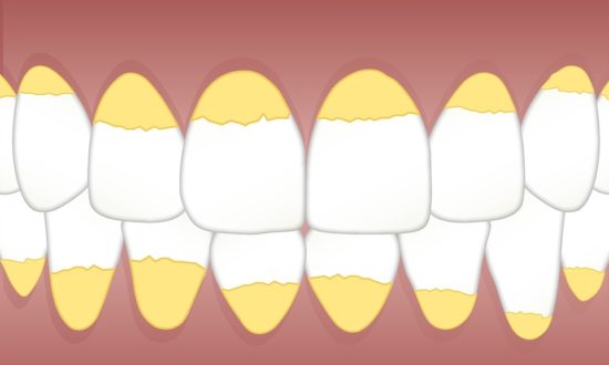 Tự “bắt mạch” sức khỏe qua răng, lợi