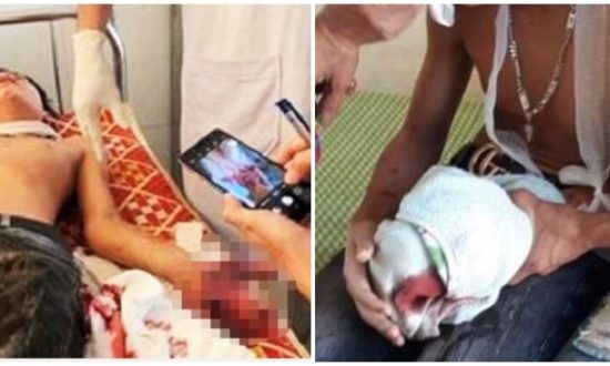 Dùng laptop đang sạc pin để học bài, 3 học sinh ở Hà Tĩnh phải nhập viện cấp cứu