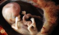 Nạn nạo phá thai: Tử vong hàng năm gấp 56 lần COVID-19
