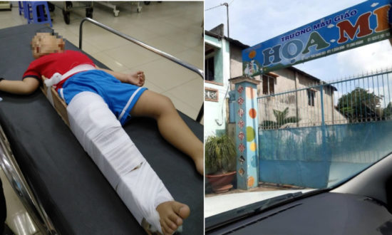 Bé 3 tuổi bị gãy xương đùi trong lớp: Cô giáo khai gác chân phải của bé lên cổ