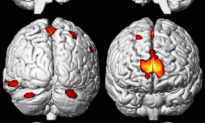 Tuổi thơ nhiễm độc chì dẫn đến giảm diện tích não và thể tích vùng hồi hải mã
