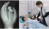 Cho tay vào máy giặt, ngón trỏ của bé trai 6 tuổi ở Hà Nội bị đứt rời, dập nát