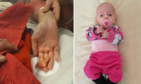 Em bé ‘tí hon’ nặng 0,5 kg với bàn chân chỉ bằng nửa ngón tay mẹ đã sống sót kỳ diệu