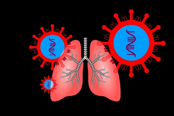 COVID-19 tàn phá phổi của con người như thế nào?
