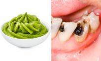 Những thực phẩm gây mùi khó chịu, nhưng công dụng không ngờ: Mù tạt trị sâu răng và đẹp da
