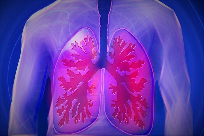 Phát hiện tại sao viêm phổi cấp do COVID-19 có thể dẫn đến tổn thương phổi mãn tính 