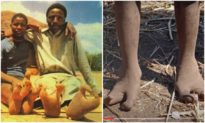 Bộ tộc người có đôi “chân đà điểu“ kỳ lạ ở châu Phi
