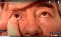 Đôi mắt 3D đầu tiên được trang bị cho con người: long lanh như mắt thật