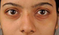 9 biểu hiện trên khuôn mặt báo hiệu tình trạng sức khỏe nội tạng