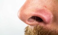 Vì sao một số người có lông mũi mọc dài, liệu có thể nhổ hoặc cắt tỉa chúng không?