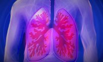Virus corona đẩy nhanh quá trình lão hóa mô phổi. Làm thế nào để bảo vệ phổi trong đại dịch?