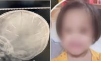 Hà Nội: Bé gái 3 tuổi bị 9 chiếc đinh găm vào sọ, nghi bị bạo hành