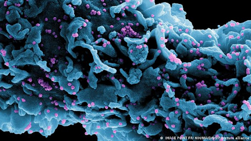 Hình ảnh hiển vi điện tử quét màu của một tế bào (màu xanh lam) bị nhiễm một chủng biến thể của các phần tử vi rút SARS-CoV-2 (màu tím B.1.1.7 của Vương quốc Anh), được phân lập từ mẫu bệnh nhân. 