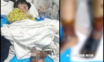 Bi kịch ở Việt Nam đang tái hiện ở Trung Quốc: Bé gái 4 tuổi nguy kịch vì bạn gái của bố bạo hành