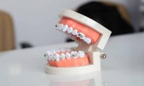 10 vấn đề cần biết liên quan đến bệnh răng miệng