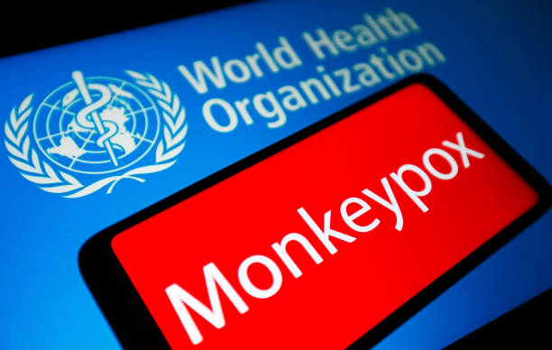 Bệnh đậu mùa khỉ đáng lo tới mức nào?