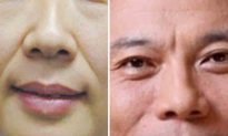 Nhận biết tình trạng sức khỏe thông qua 7 nếp nhăn trên khuôn mặt (Phần 1)