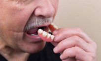 Sự khác biệt giữa trồng răng, bọc răng sứ và lắp răng giả là gì?