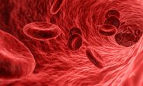 Nhóm máu có thể ảnh hưởng đến nguy cơ bị đột quỵ trước tuổi 60, theo nghiên cứu