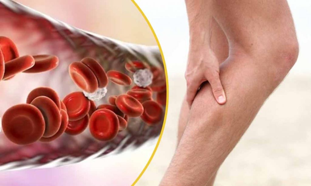 4 dấu hiệu cho thấy mạch máu bị tắc nghẽn. Nguyên nhân gây lão hóa mạch máu là gì?