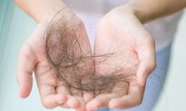 3 nguyên nhân chính gây rụng tóc và cách khắc phục 