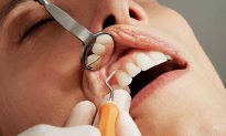 Làm sạch kẽ răng hàng ngày có thể giảm 40% tình trạng chảy máu nướu răng