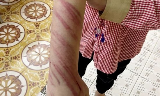Hải Phòng: Bé trai 7 tuổi bị bạn trai của mẹ bạo hành