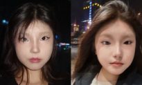 Cô gái 18 tuổi ở Trung Quốc bẩm sinh có hai đồng tử khác màu