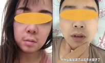 Di chứng lạ hậu Covid ở Trung Quốc: Nữ giới bị 'mọc' râu và 'rụng' râu ở nam giới
