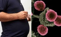 13 bệnh ung thư có liên quan đến béo phì và đang ngày càng gia tăng (Phần 2)