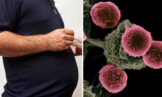 13 bệnh ung thư có liên quan đến béo phì và đang ngày càng gia tăng (Phần 1)