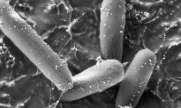 Cảnh giác với siêu vi khuẩn E. Coli đặc biệt nguy hiểm