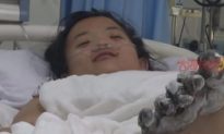 Cô gái Trung Quốc bị điện giật khi vừa nghịch điện thoại vừa sạc, ngón chân bị bỏng và có thể phải cắt cụt chi