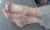 Nếu 5 dấu hiệu này xuất hiện ở chân, nghĩa là chân bạn đang bắt đầu già đi và có thể gặp khó khăn trong việc đi lại