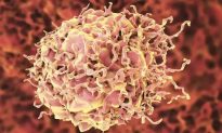 Nghiên cứu: U tủy, bệnh Bạch cầu và các bệnh ung thư khác có liên quan đến COVID-19