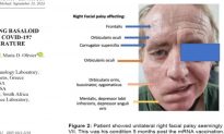 Tử vong do ung thư sọ mặt sau khi tiêm vaccine COVID 5 tháng