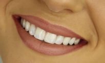 Điều gì sẽ xảy ra với những người bị mất răng lâu năm mà không sửa chữa?