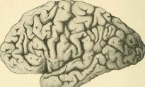 4 triệu chứng teo não giai đoạn đầu