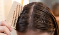 Tóc bết dầu: 9 cách chăm sóc cho da đầu nhờn