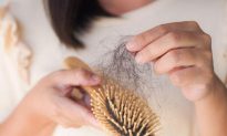 Rụng tóc báo hiệu điều gì về sức khỏe? Các chiến lược điều trị và ngăn ngừa