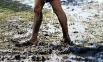 Bị vi khuẩn ‘ăn’ từ chân lên bụng sau khi lội bùn, người đàn ông nguy kịch