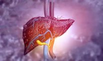 Vai trò quan trọng của khí trong bệnh ung thư gan, theo Diễn đàn bác sĩ ba tầng