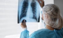 Mỹ phê duyệt thuốc điều trị ung thư phổi giá gần… 20 tỷ đồng
