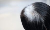 Ở độ tuổi nào người ta thường bắt đầu có tóc bạc? Độ tuổi này có lẽ muộn hơn bạn nghĩ