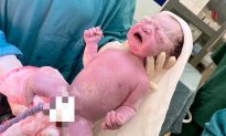 Hiếm gặp: 2 em bé chào đời, mang theo vòng tránh thai 'trả' mẹ