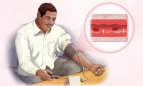 Tăng huyết áp: triệu chứng, nguyên nhân, điều trị và các phương pháp tự nhiên